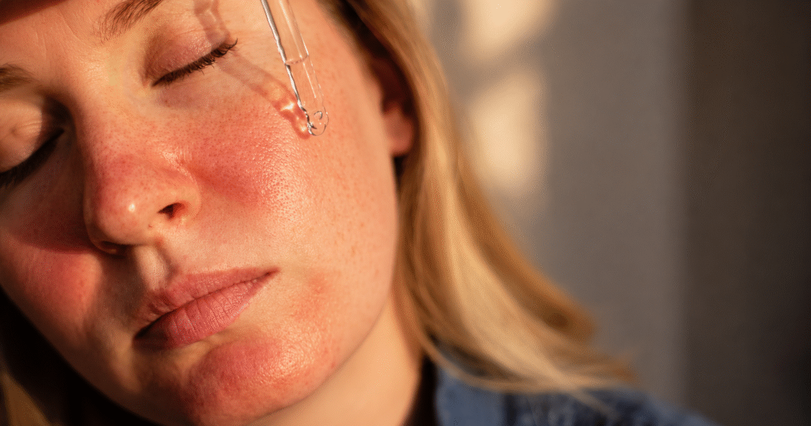 over exfoliated skin