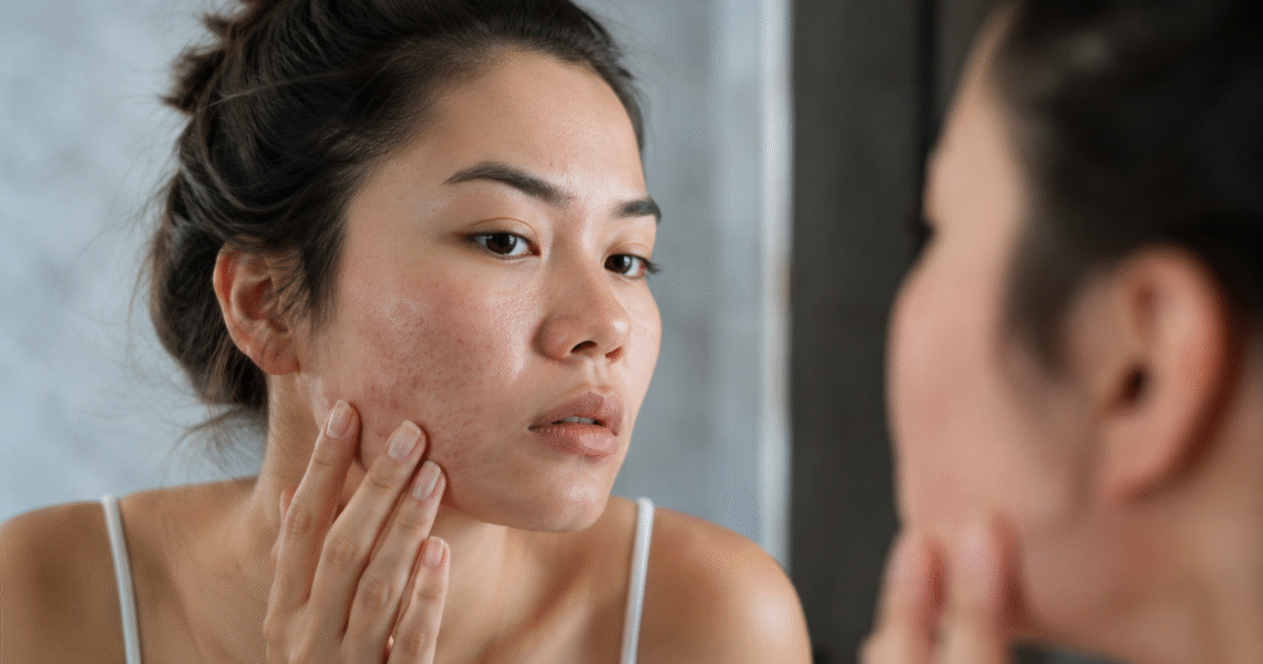 Rough skin on face