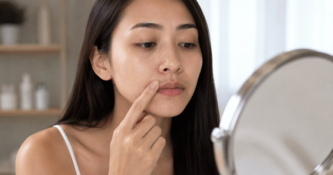 How to get rid of mustache shadow