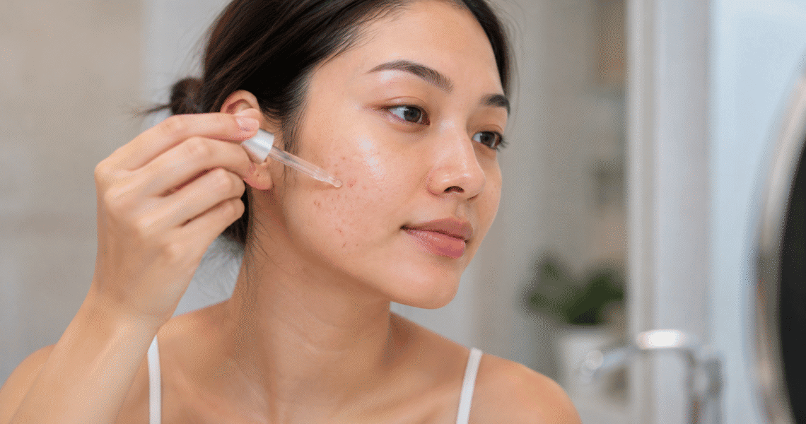 Does salicylic acid help with acne scars​
